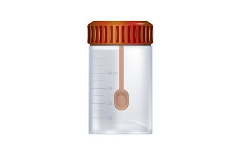 Behälter zum Sammeln von Kot für die Parasitenanalyse
