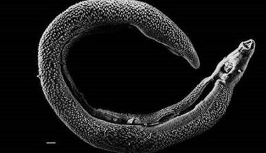 Was Parasiten in der Leber einer Person leben können