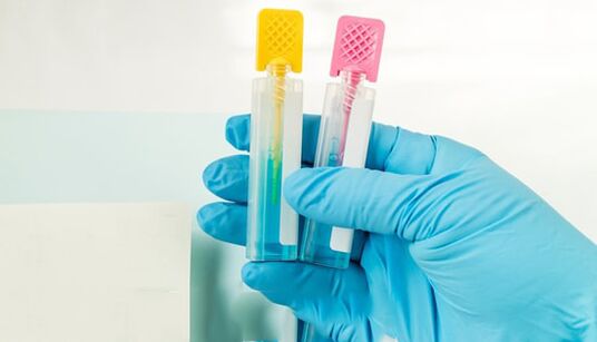 Diagnosemethoden mit Parasit