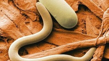 Parasiten im menschlichen Körper